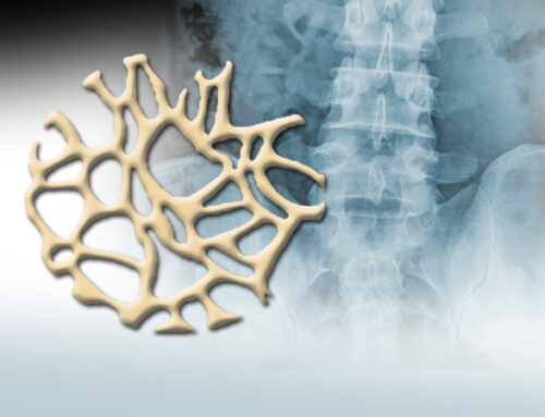 DIABETE O PRE-DIABETE (resistenza all’insulina) E OSTEOPOROSI.